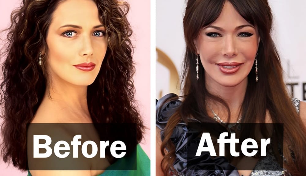 15 Celebrities Who Look Completely Different After Plastic Surgery