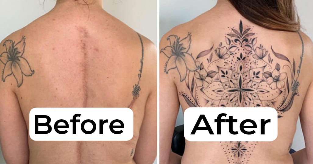 Tattoo Artist Turns Scars into Stunning Works of Art